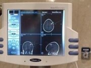 Com la neuronavegació revoluciona la cirurgia cerebral i de columna